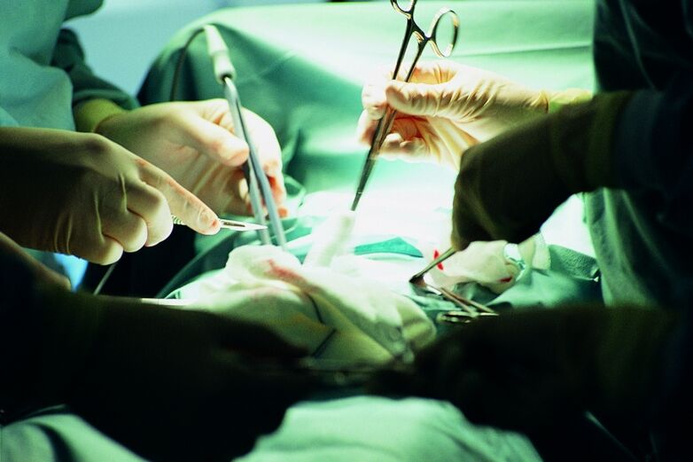 surgical enlargement of the penis